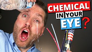 Chemical Eye Injury  How To Wash A Chemical Out Of Your Eye [upl. by Genesia522]