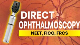 Direct Ophthalmoscopy Tips and Tricks [upl. by Rosenblast999]