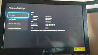 How to fix teredo ip issue on Xbox One and Series X 100 Still working in 2024 [upl. by Dett]