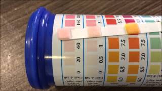 What Type Of Aquarium Water Testing Kit Should You Use Strips VS master test kit [upl. by Shields]