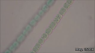 Anabaena under the Microscope [upl. by Diahann]