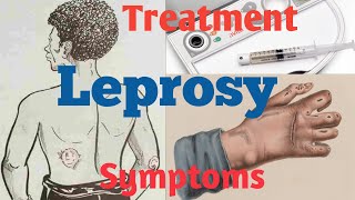 What is Leprosy  What causes Leprosy  Leprosy Diagnosis [upl. by Airdnaz651]