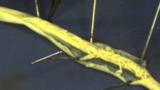 Roundworm dissection [upl. by Prior401]