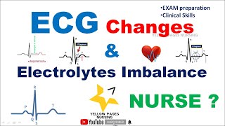 ECG changes in electrolyte imbalance [upl. by Aneehsit]