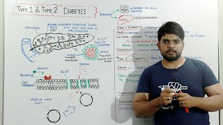 Diabetes mellitus type 1 and Type 2 [upl. by Ynafets]