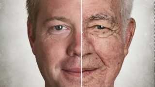 Skin Aging  What are the early signs of aging [upl. by Aggy]