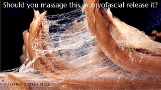 What is myofascial release  Whats the difference between myofascial release vs massage [upl. by Ario]