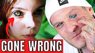 6 People Who Went Blind Getting Eyeball Tattoo Eyeball Tattoos Gone Wrong [upl. by Eneleahs]