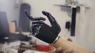 Prótesis de mano Bebionic [upl. by Nabe]