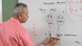 Blood Transfusion Reaction Part 13 Hematology [upl. by Lehet]