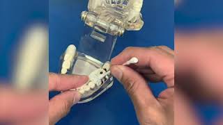 How to use temporary dental filling material [upl. by Yorke]