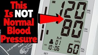 120 OVER 80 IS NOT NORMAL BLOOD PRESSURE RANGE  So What Is A Normal Blood Pressure Reading [upl. by Riki693]