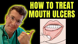 How to recognise and treat Mouth Ulcers getting rid of canker sores  Doctor ODonovan explains [upl. by Azeel]