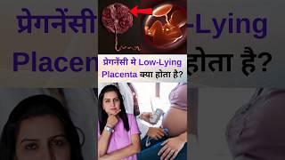 प्रेगनेंसी मे LowLying Placenta क्या होता है [upl. by Irianat]