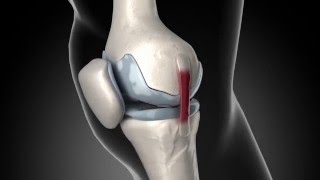 Anatomy of knee pain [upl. by Rob]