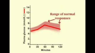 Glucose Tolerance Test Expected normal results [upl. by Ygief]