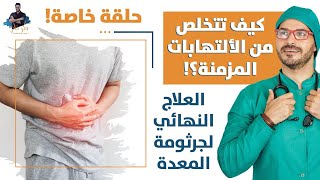 علاج جرثومة المعده الفعالالتخلص من الالتهابات المزمنة وبدون أدوية [upl. by Kutzer]