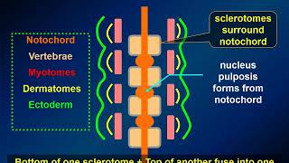 MedPix Video  Nonglial Tumors Chordoma Radiology [upl. by Ahsinej]