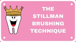 Stillman Brushing Technique [upl. by Henry808]