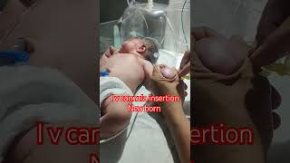 I v cannula insertion New born baby admission NICU care neonatal baby reels newbornbaby baby [upl. by Obrien]