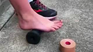 How to treat Plantar Fasciitis fasciopathy with Fascia release [upl. by Jandel]