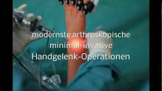 ARTHROSKOPISCHE HANDGELENK OPERATION minimal invasive Handgelenksoperation Handgelenk Op [upl. by Ettenahc]