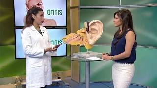 Causas y síntomas de la otitis HOY EN SALUD [upl. by Sivrad]