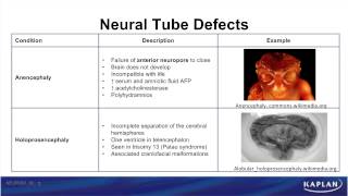 USMLE® Step 1 Neuroscience Development of CNS Animation [upl. by Amikahs]