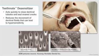 Teethmate Desensitizer [upl. by Esinal]