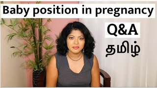 Baby positions during pregnancy Tamil  Baby head engagement symptoms in Tamil  Cephalic Tamil [upl. by Samid]