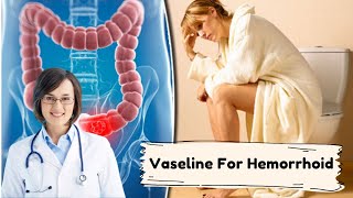 How To Cure Hemorrhoids Naturally  Vaseline For Hemorrhoid [upl. by Etteiluj750]