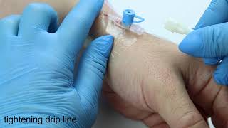 How to start IV drip Step by step tutorial from nurse [upl. by Peltier971]