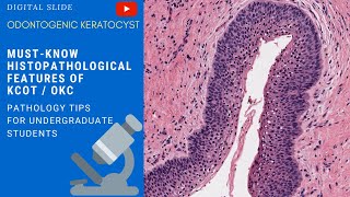 Odontogenic Keratocyst Histopathology [upl. by Acinot]