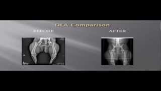 The Importance of quotPrecise Positioning Technique™quot for OFA radiographs for Canine Hip Dysplasia [upl. by Underwood481]