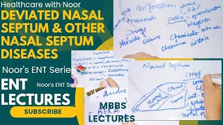 deviated nasal septum  disorders of nasal septum  nasal septum diseases  DrNajeebLecturesJr [upl. by Raimondo]