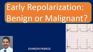 Early Repolarization Benign or Malignant [upl. by Betta]