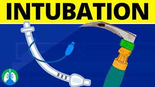 Intubation Medical Definition  Quick Explainer Video [upl. by Idorb]