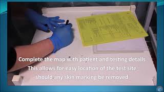 How to perform an Minimum Erythemal Dose MED test [upl. by Halueb]