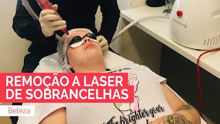 Eu amp Você  Remoção a laser de sobrancelha e tatuagem [upl. by Bannasch]