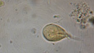 Giardia Lamblia CIAB wwwciabes [upl. by Sherill]