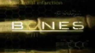 Bones  1x01  Pilot Promo [upl. by Nola]