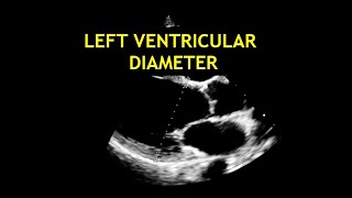 How to measure the LEFT VENTRICULAR DIAMETER Echocardiography [upl. by Burnett840]