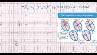 20 ECG  Quiz  Dr Synapse [upl. by Renault]