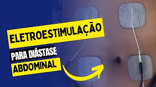 Eletroestimulação para diastase abdominal [upl. by Forster]