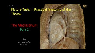 Picture Tests in Anatomy  Thorax  Mediastinum 2 [upl. by Laamaj]