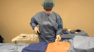 Minimally invasive awake liposuction [upl. by Enileda]