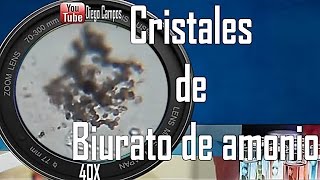 Cristales de biurato de amonio  Uroanalisis [upl. by Anrym473]