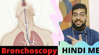 Bronchoscopy Explained in Hindi  ब्रोंकोस्कोपी क्या है  Types of Bronchoscopy [upl. by Aisatsana]