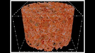 Lyophilization Freeze drying pharmaceuticals [upl. by Niwrehs288]