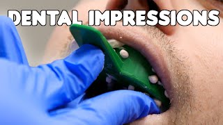 Dental Impressions amp Pouring Teeth Models [upl. by Gaskin]